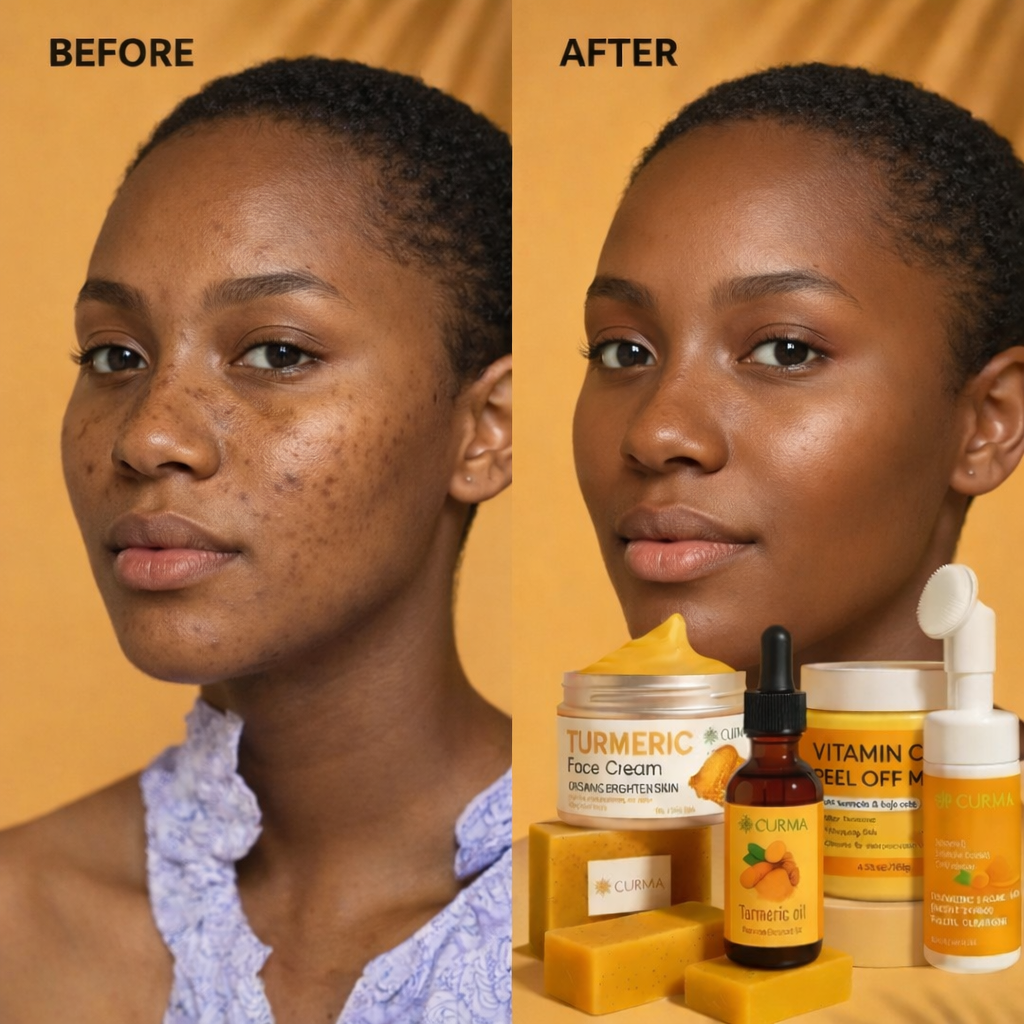 Le Kit Curma – 5 soins réunis pour une peau transformée